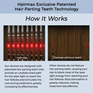 HairMax LaserBand 41 ComfortFlex, image 3