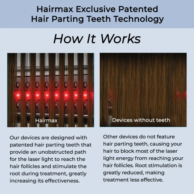 HairMax LaserBand 41 ComfortFlex, image 3